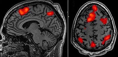 mri-appointments pictures-requisition-form